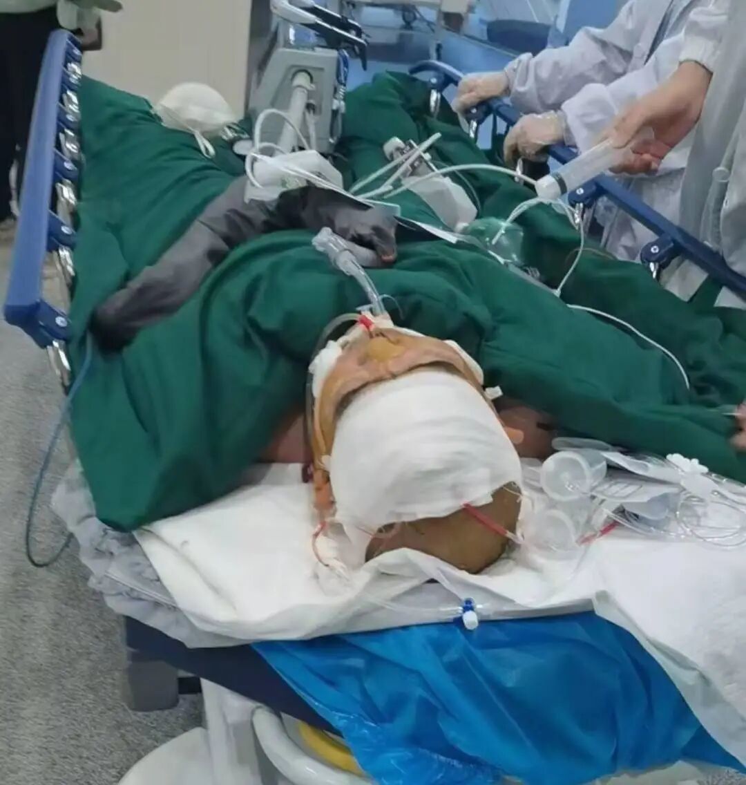 李某抢救现场(家属账号截图)