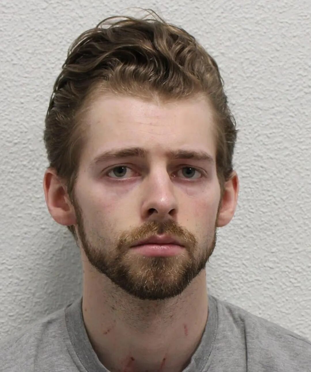 米歇尔斯被捕照片,脖子上有明显抓痕