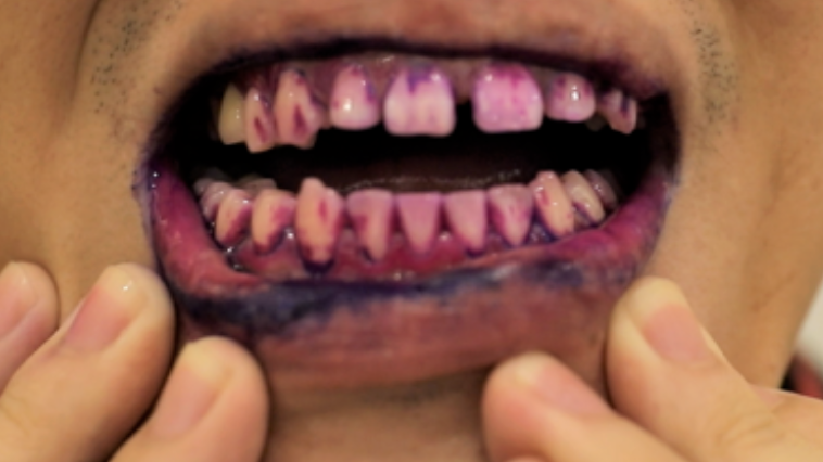 图片来源:丁香一位实验小哥