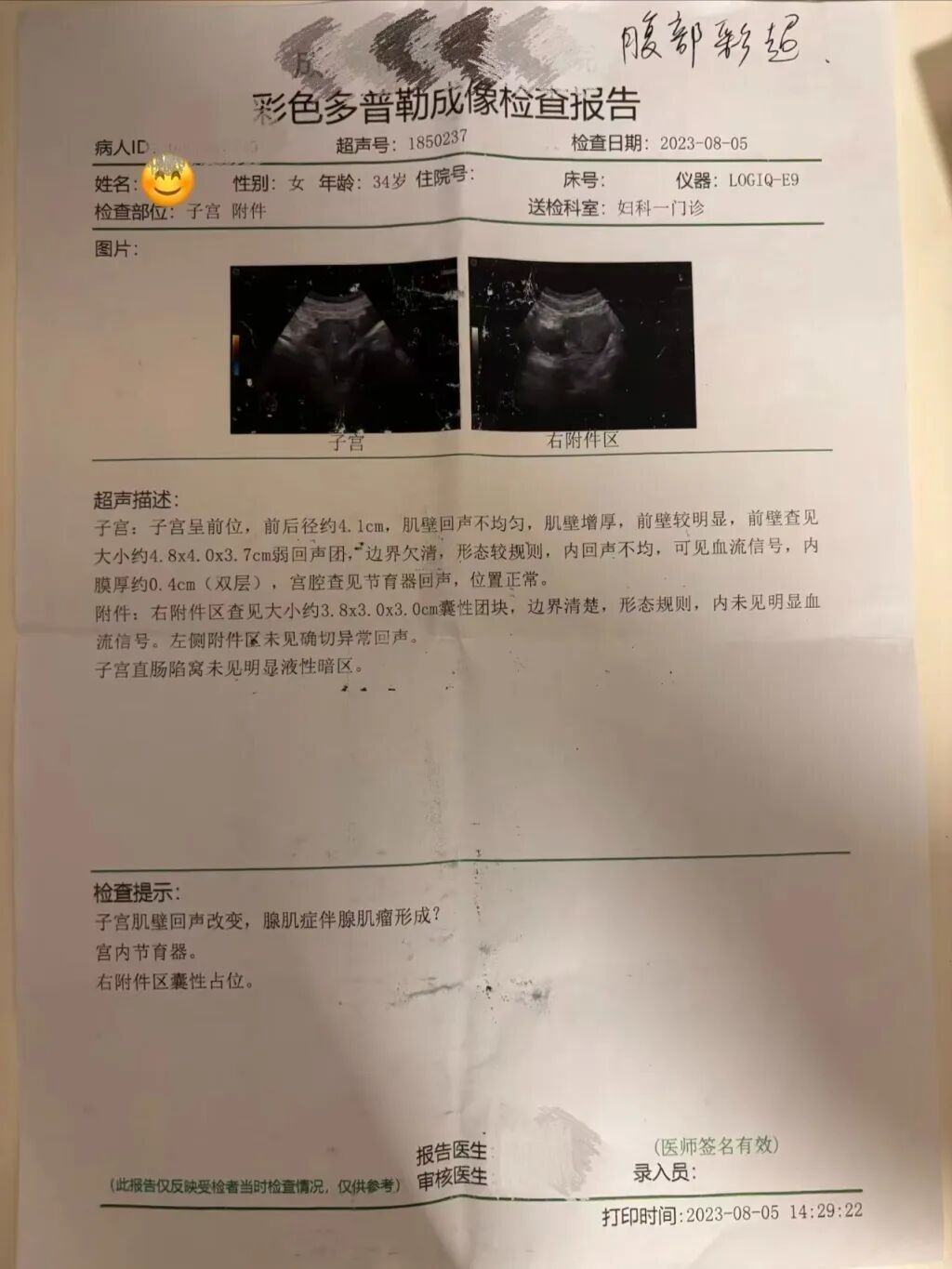 上环后林月复查子宫状况的彩超单