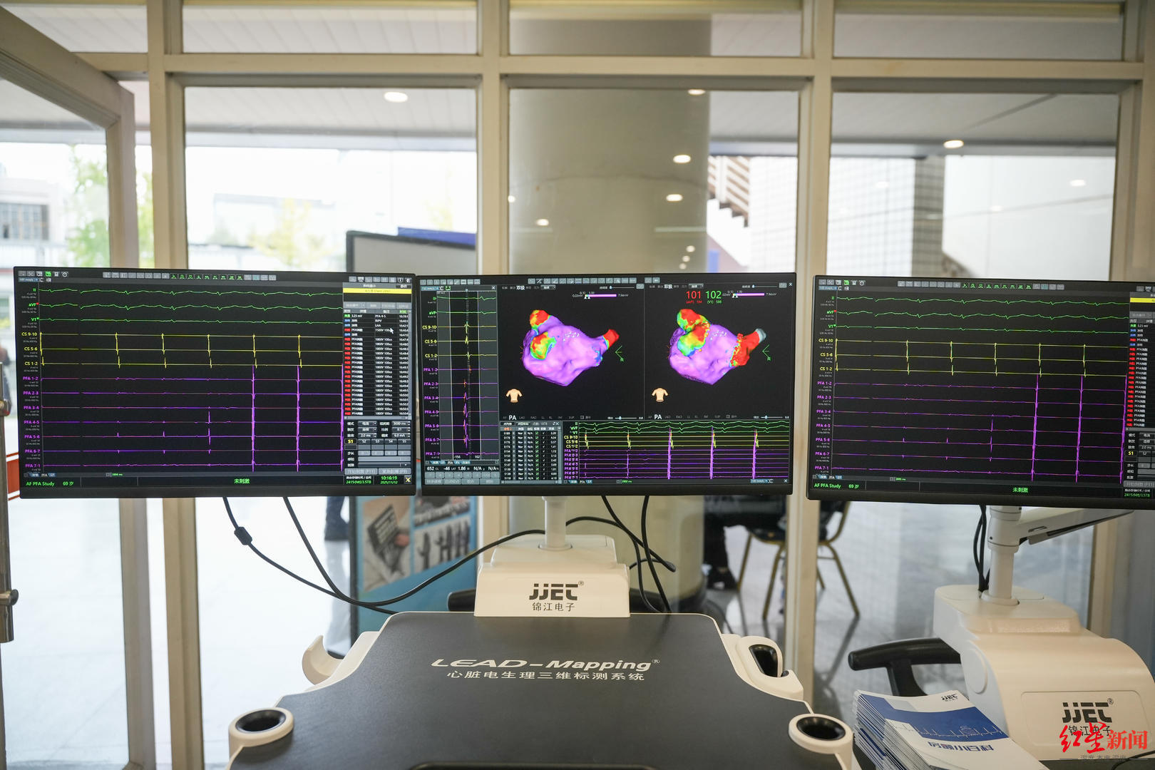 手术车怎么对接实验室成果走向生产线！AI质检汽车座椅、“定点清除”手术刀，成都这场对接会“秀”出科创肌肉_https://www.jmylbn.com_新闻资讯_第4张