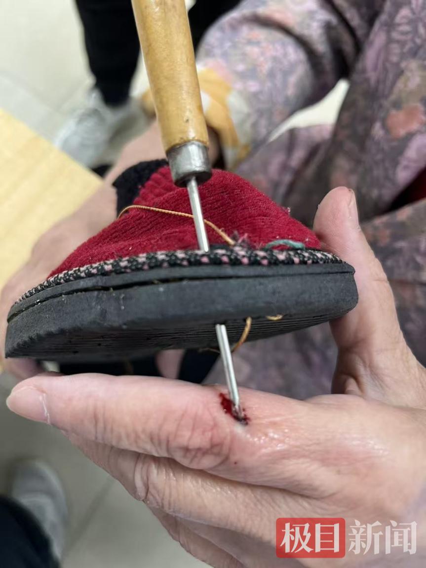 怎么制造手术钩针七旬奶奶赶制冬鞋时遭钩针穿指，医生紧急手术解危机_https://www.jmylbn.com_新闻资讯_第1张