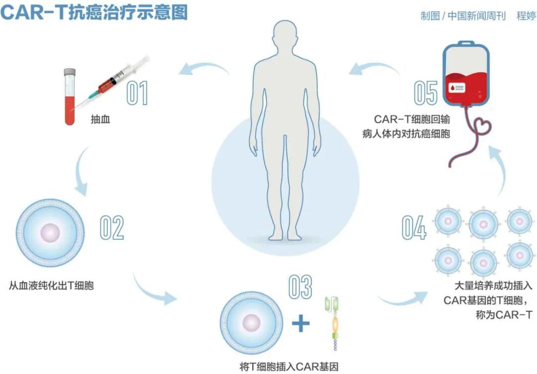 百万元的抗癌药,有望大幅降价?