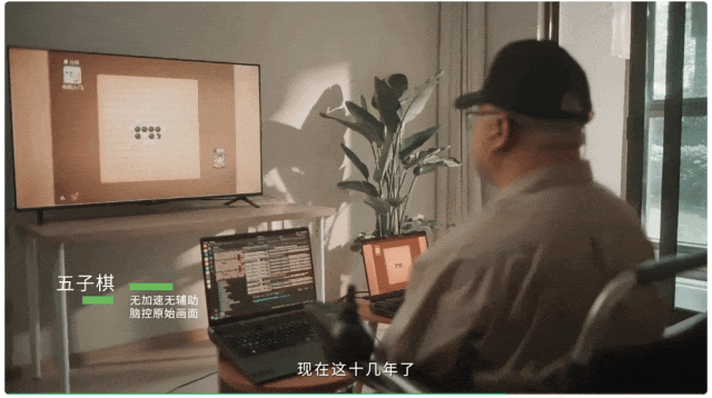 比马斯克Neuralink工艺更先进!中国成功开展首例侵入式脑机接口临床试验