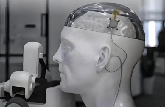 脑机接口,现在可以刷医保了