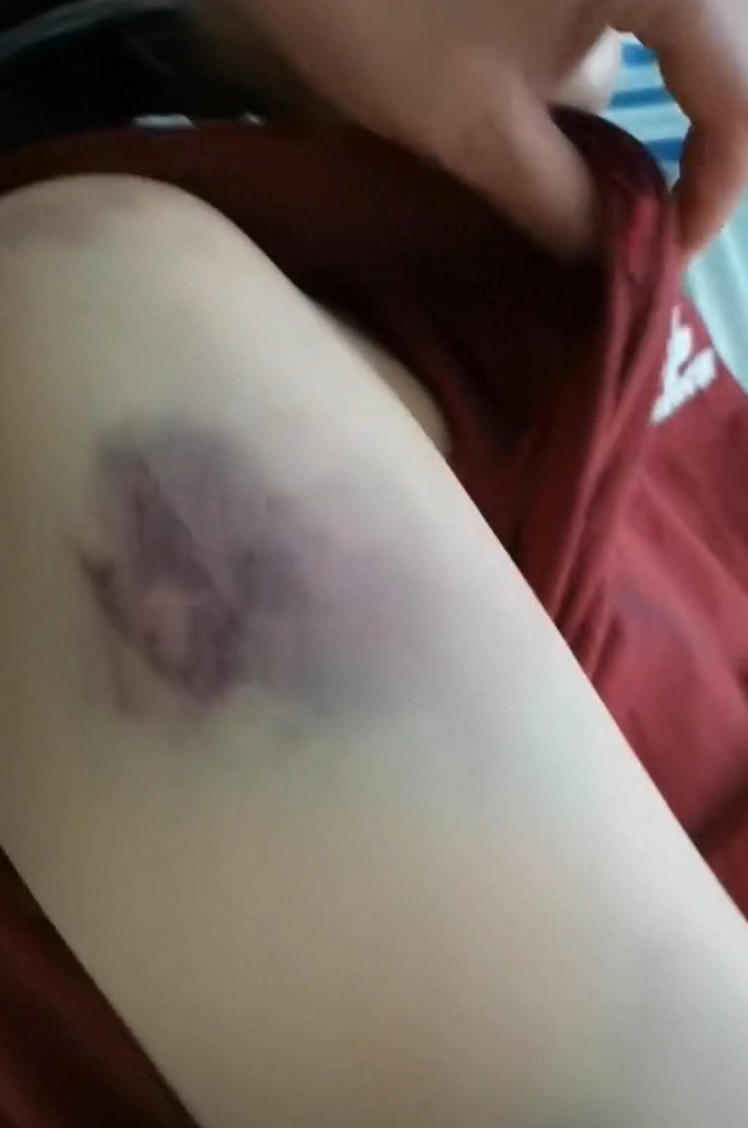 ▲曹某某身上的伤