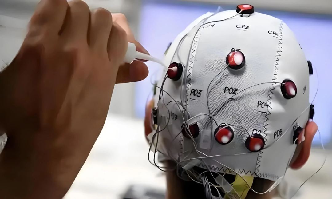 脑机接口,现在可以刷医保了