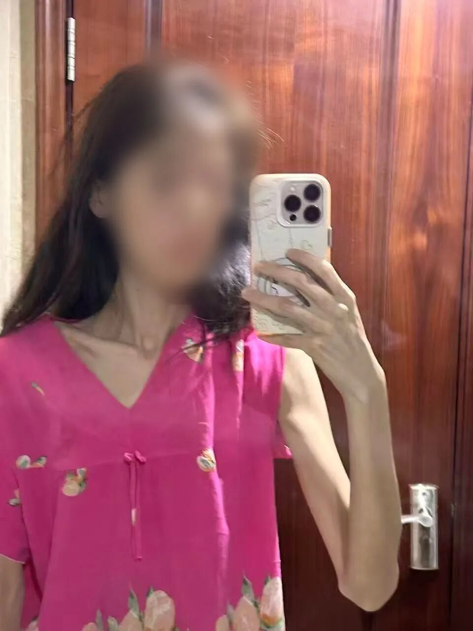 1.76米的喆喆,体重最轻时只有34kg