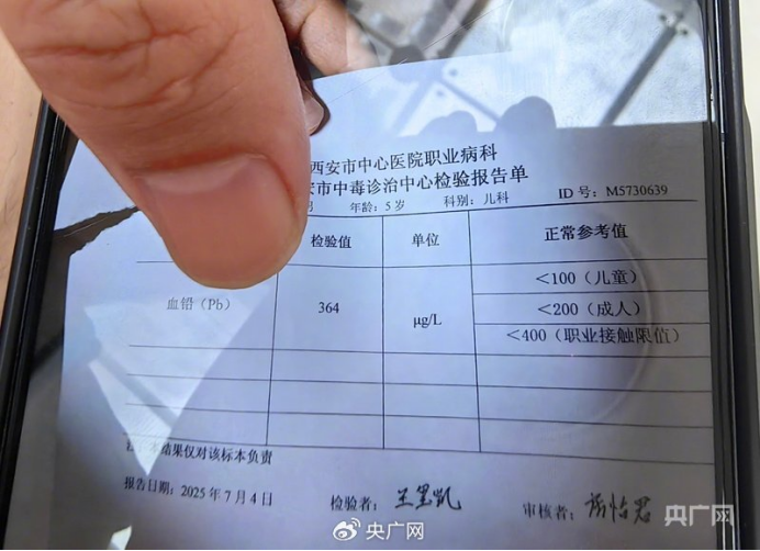 △图上患儿的血铅值达364微克/升，远超国家健康标准100微克/升，处于中度铅中毒状态