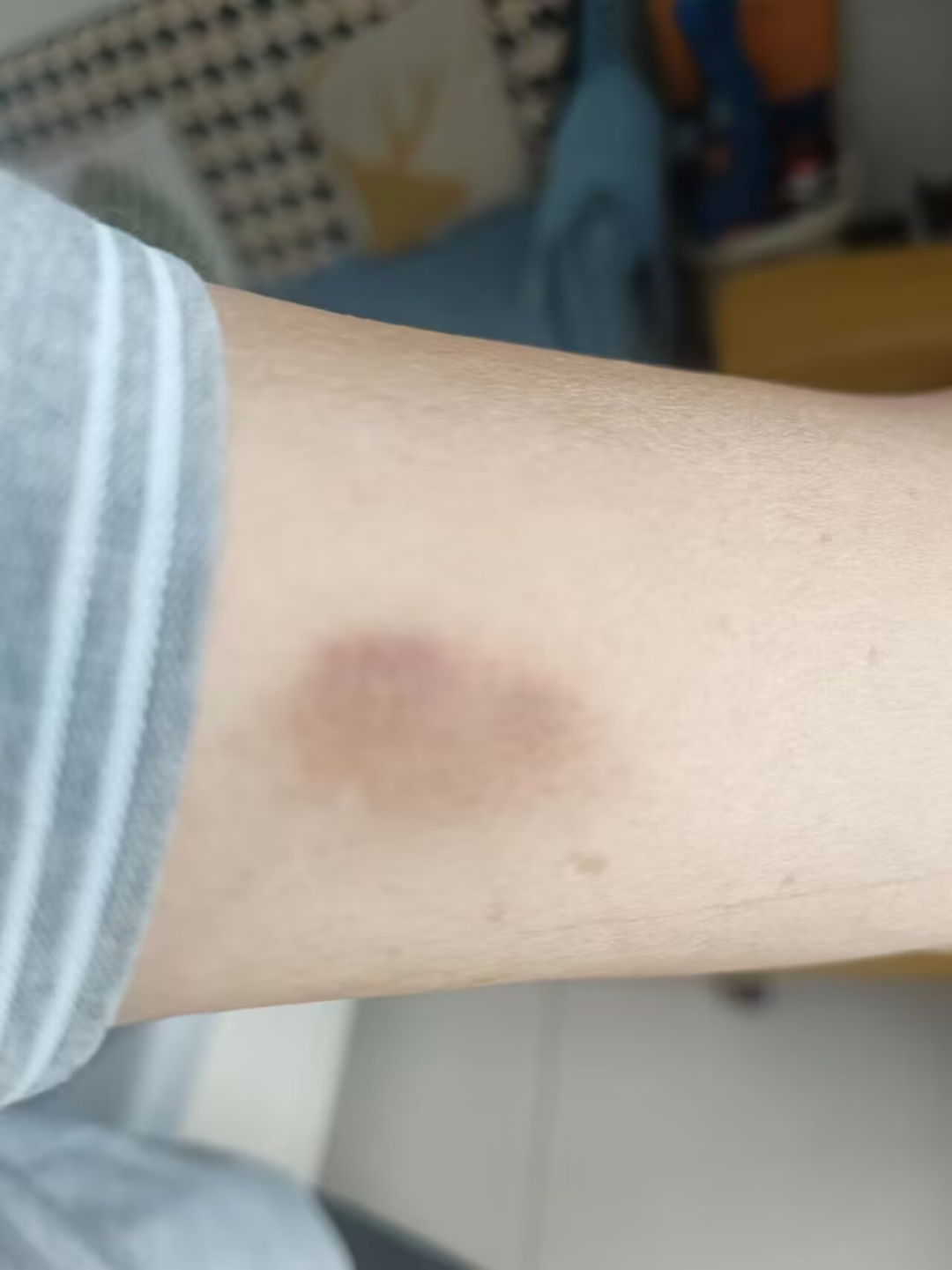 小卉生前伤情 图/受访者提供