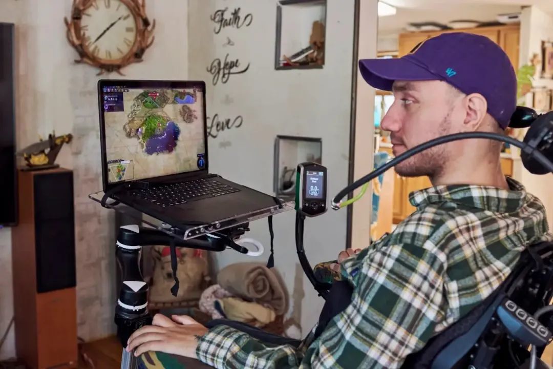 脑机接口,现在可以刷医保了