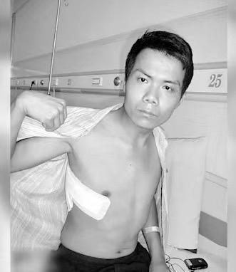 张海超开胸验肺16年后：如今生活一地鸡毛 泪流不止…