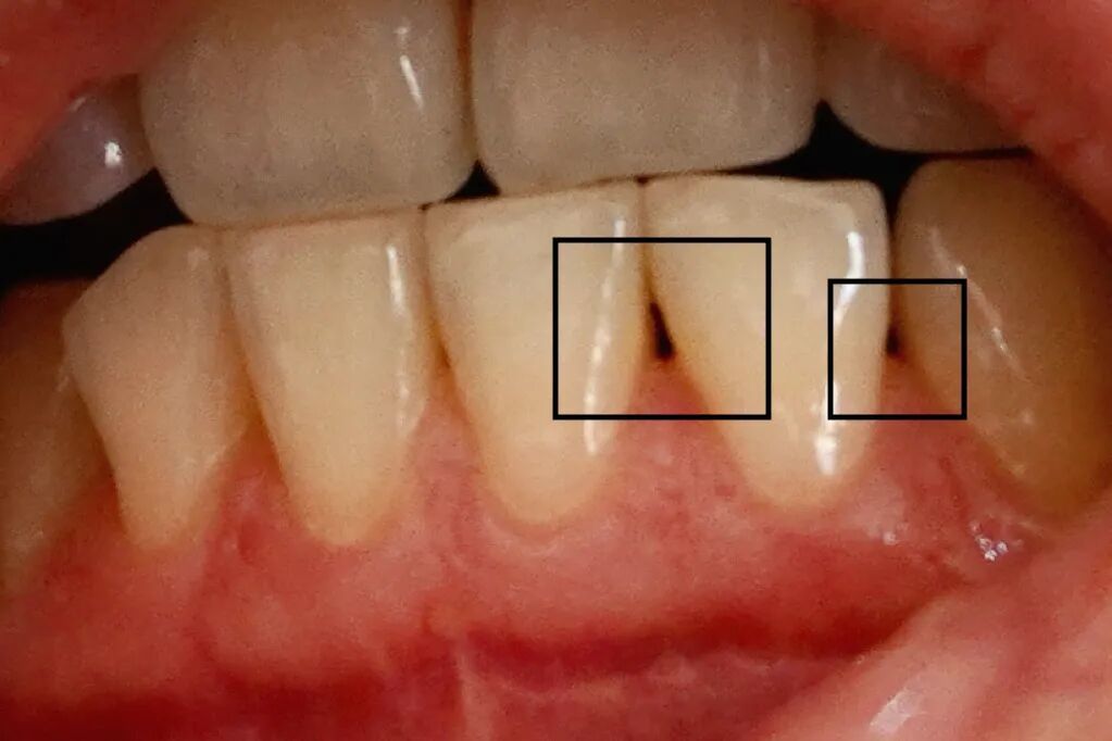 图片来源:自己拍的