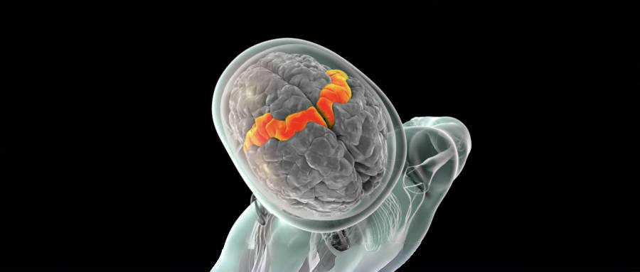 让渐冻症患者实时对话、“哼唱”旋律!美国高校脑机接口新进展,延迟仅10ms