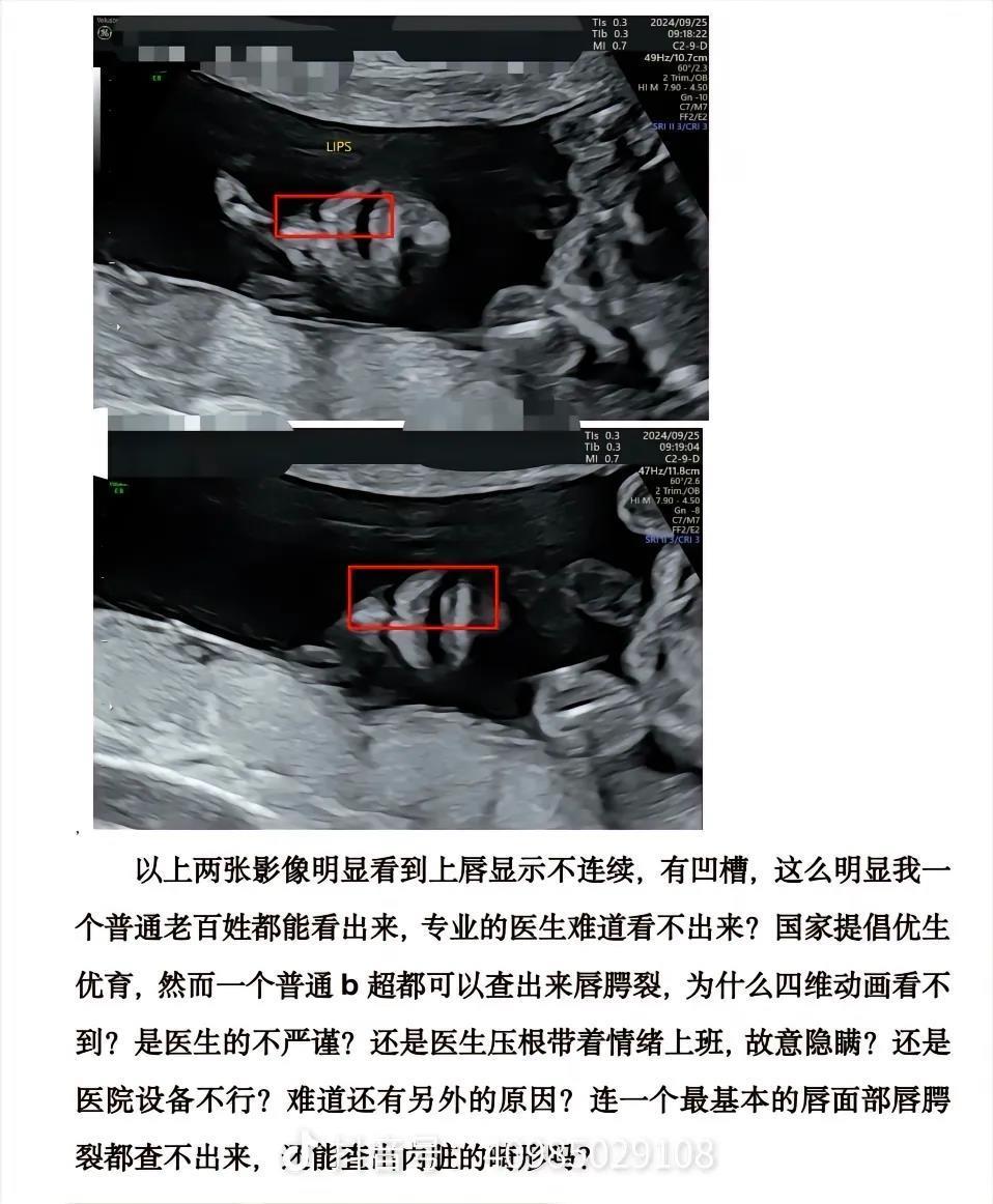 当事人认为存在问题的影像