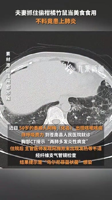 夫妻抓住偷柑橘竹鼠当美食食用，不料竟患上肺炎