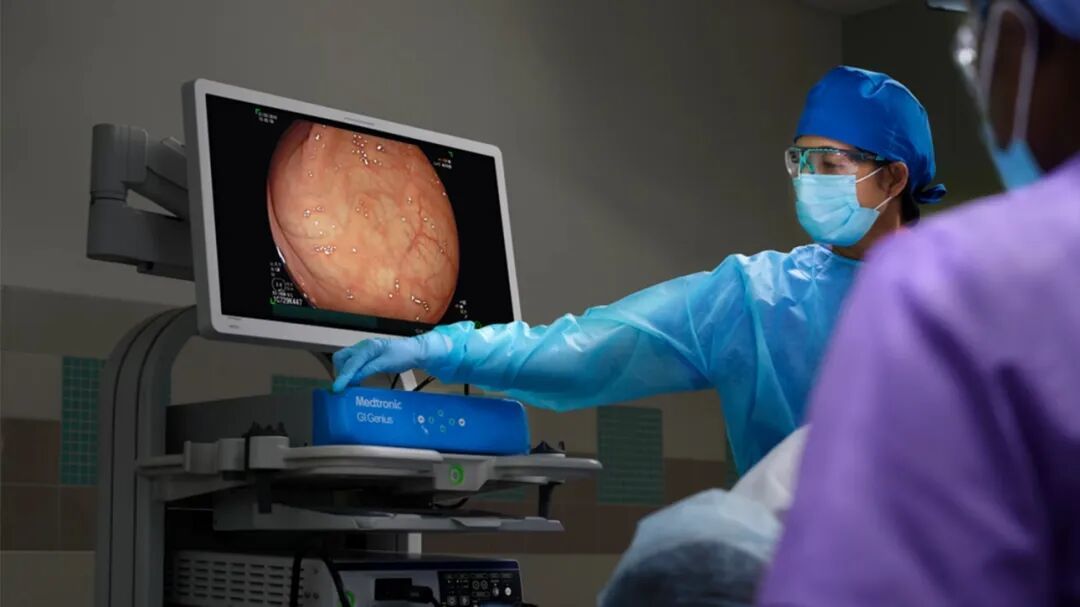 Medical professional using the Medtronic GI Genius system, with an endoscopic image displayed on a monitor.
