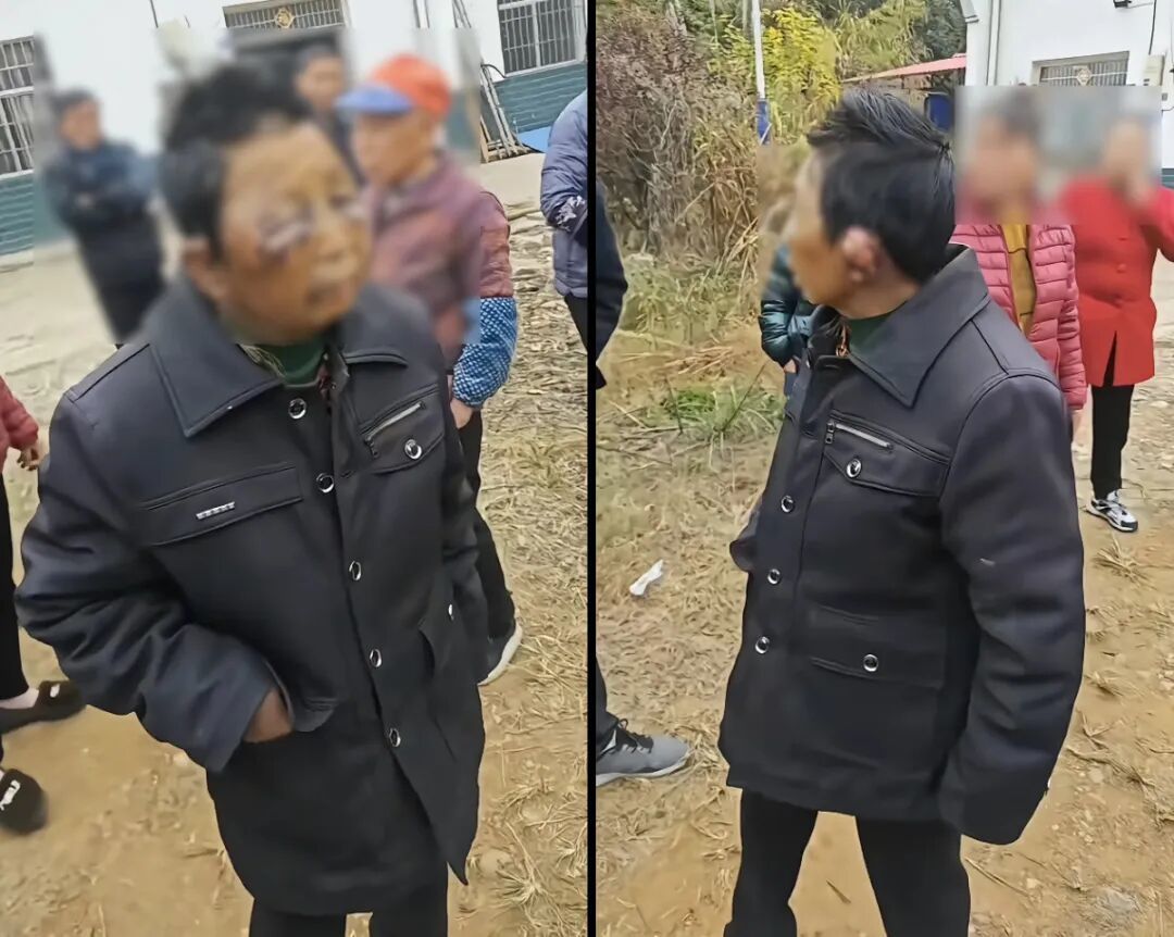 被殴打老人(网络视频截图)