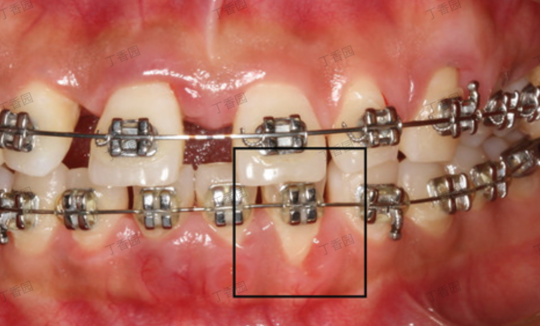 图片来源:丁香园