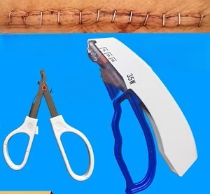 手术用吻合器是什么外科手术的神兵利器——一次性使用外科吻合器_https://www.jmylbn.com_新闻资讯_第4张