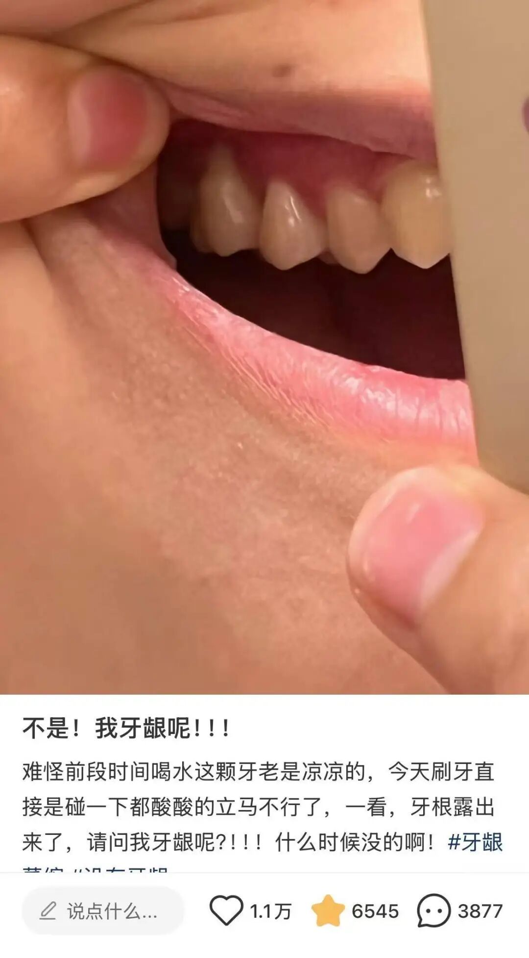 图片来源:小🍠