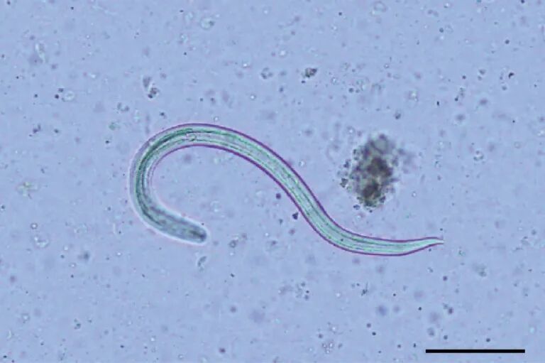 广州管圆线虫(Angiostrongylus cantonensis)| P. Rivory