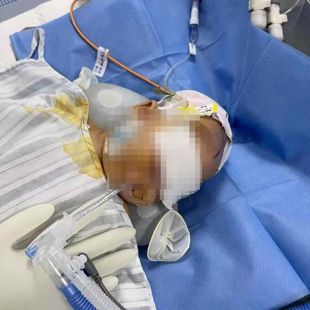 ▲抢救时的女婴