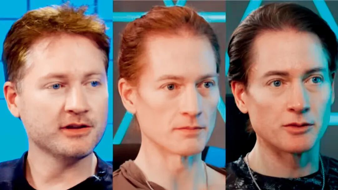 上图:进行脸部脂肪转移后,布莱恩·约翰逊出现了严重过敏反应。