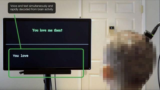 AI打破脑机接口延迟壁垒:瘫痪者“开口”仅需一秒