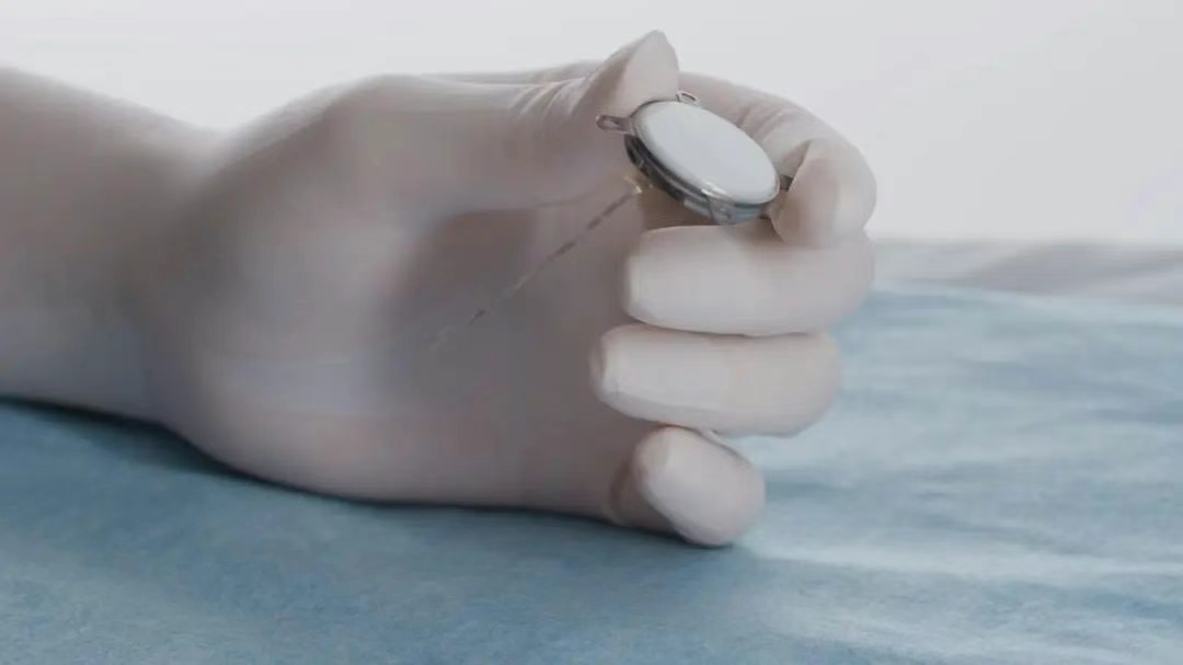 比马斯克Neuralink工艺更先进!中国成功开展首例侵入式脑机接口临床试验