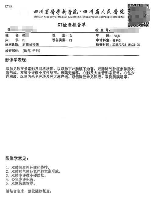 翟女士2月28日CT报告单