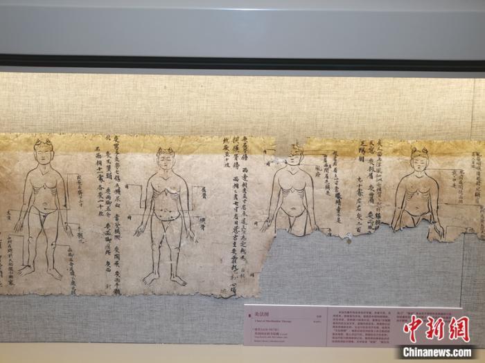 展出的《灸法图》（复制）　中新网记者　上官云　摄