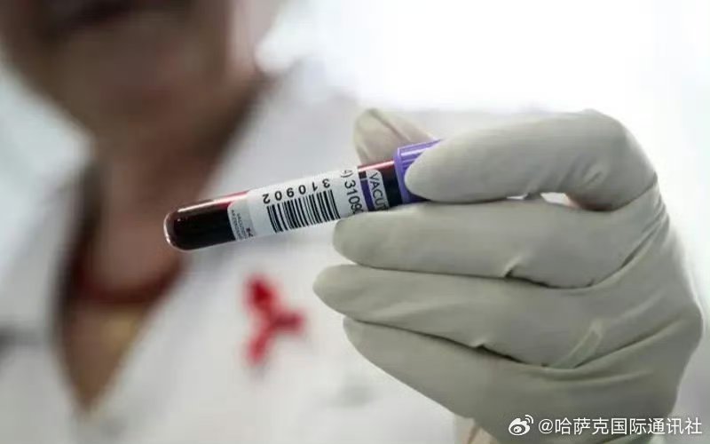 【乌兹别克拟出台新规:在境外停留超90天或将强制检测艾滋病】据哈通社