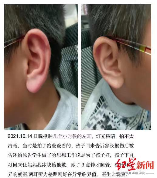 ▲耿女士孩子被揪耳朵前后(左图为被揪后)对比 受访者供图