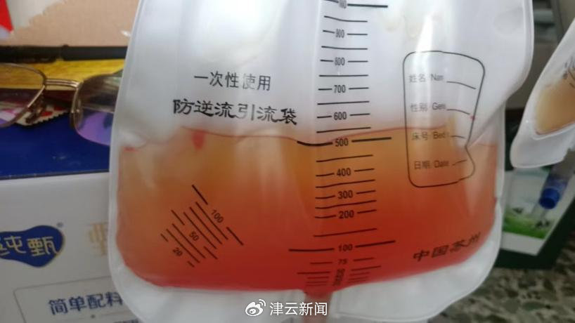 事發(fā)后曹依一直在醫(yī)院