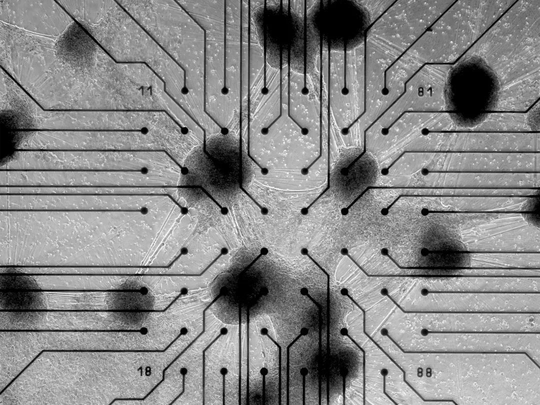 20万一台的“人脑计算机”,可能是人类战胜AI的唯一方式?