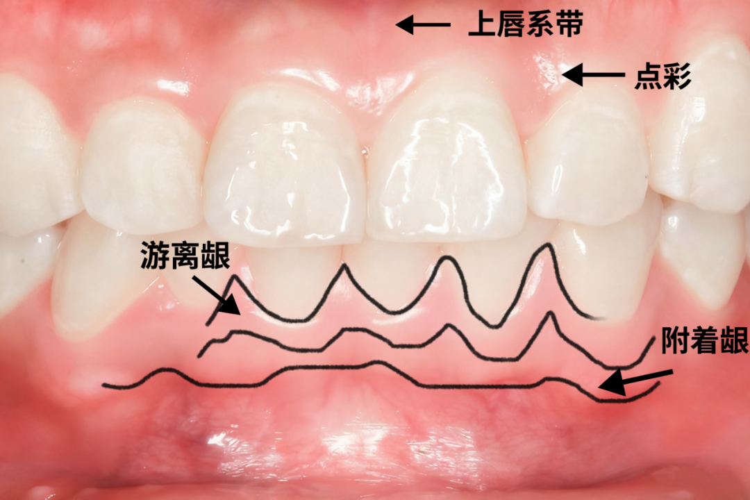 图片来源:自己画的