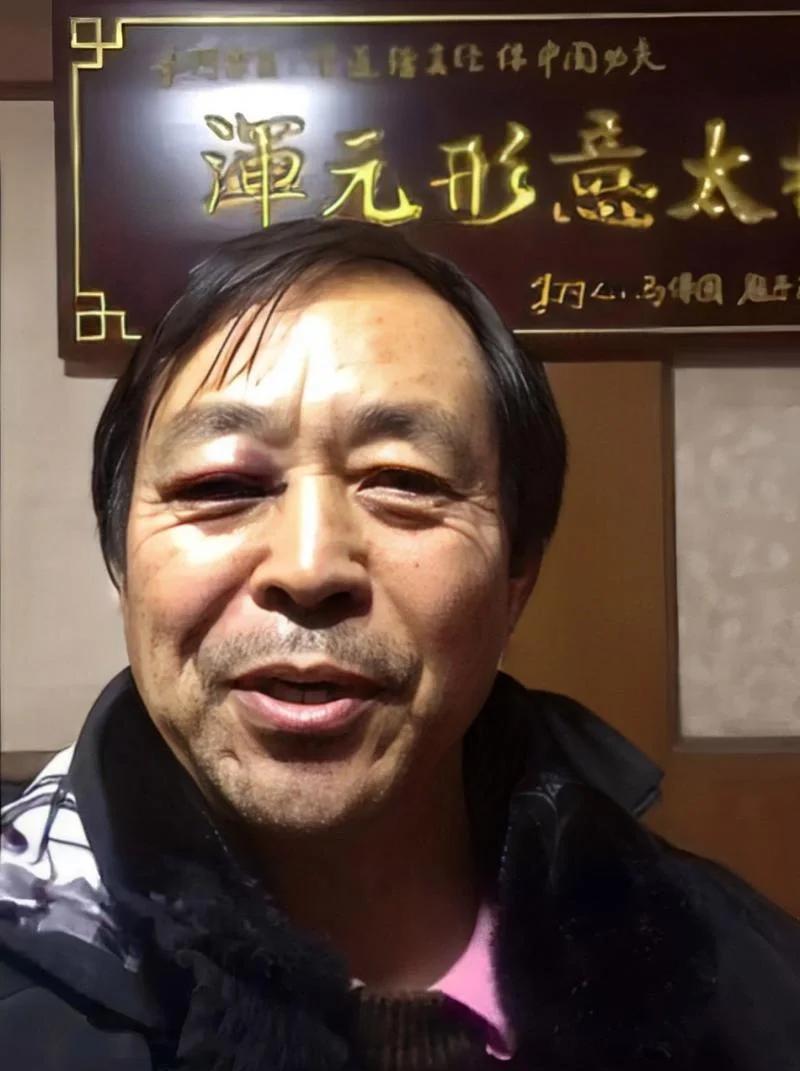73岁马保国不讲武德！擂台比武被秒杀太丢人 恼羞成怒用手抓对手脸_73岁马保国不讲武德！擂台比武被秒杀太丢人 恼羞成怒用手抓对手脸_