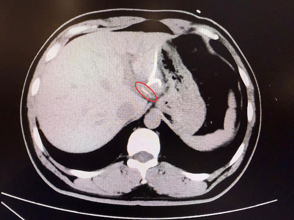 患者李先生影像检查。本文图片均来自复旦大学附属中山医院