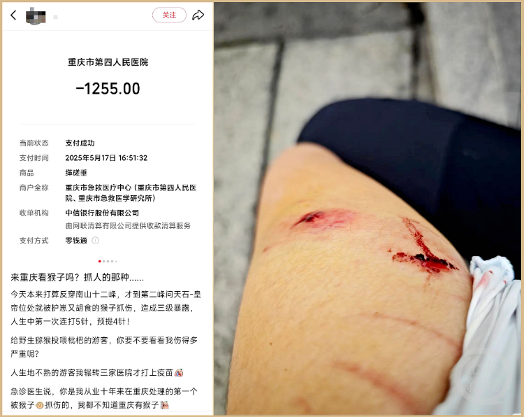 孟女士发帖讲述遭遇（左）， 孟女士的伤情（右）。 受访者供图
