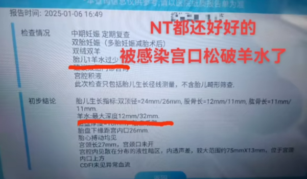 29ce49ff387307d379ec8ad04e208c3.png