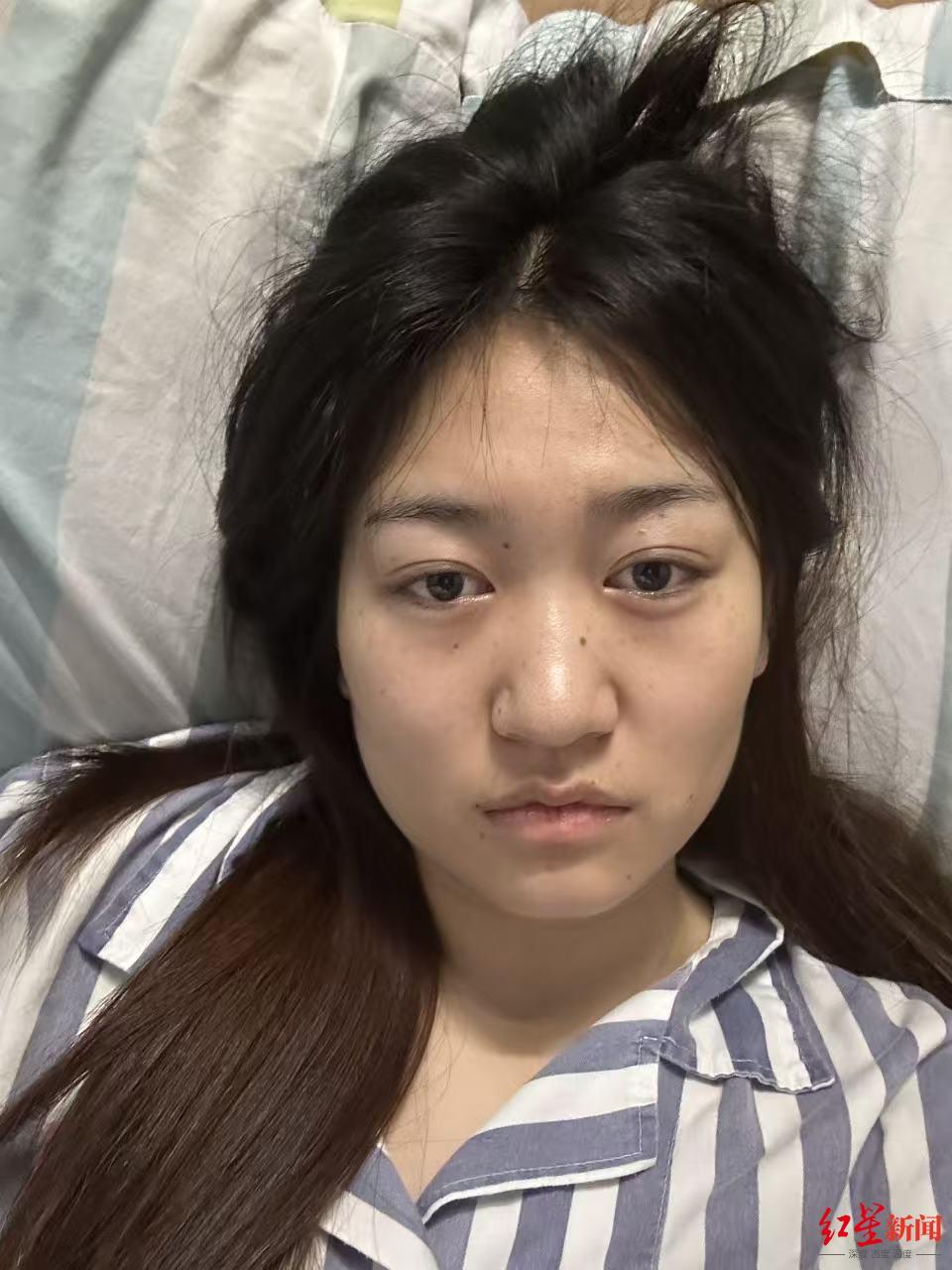▲躺在医院病床上的小徐