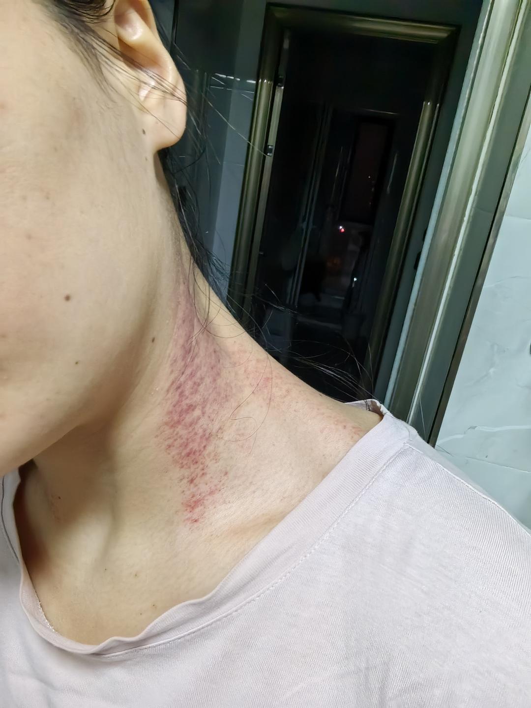 ▲在董文卉手机中发现的自拍照,显示其身体多处淤青