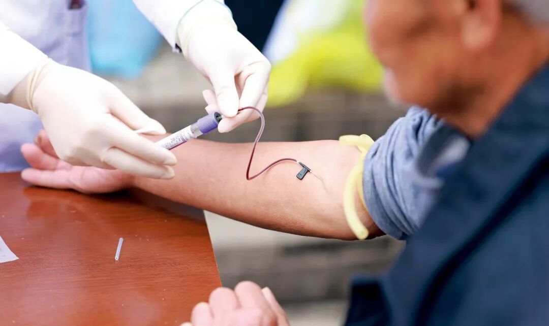 2023年12月1日,贵州省铜仁市疾控中心工作人员为市民免费进行艾滋病筛查。图/视觉中国