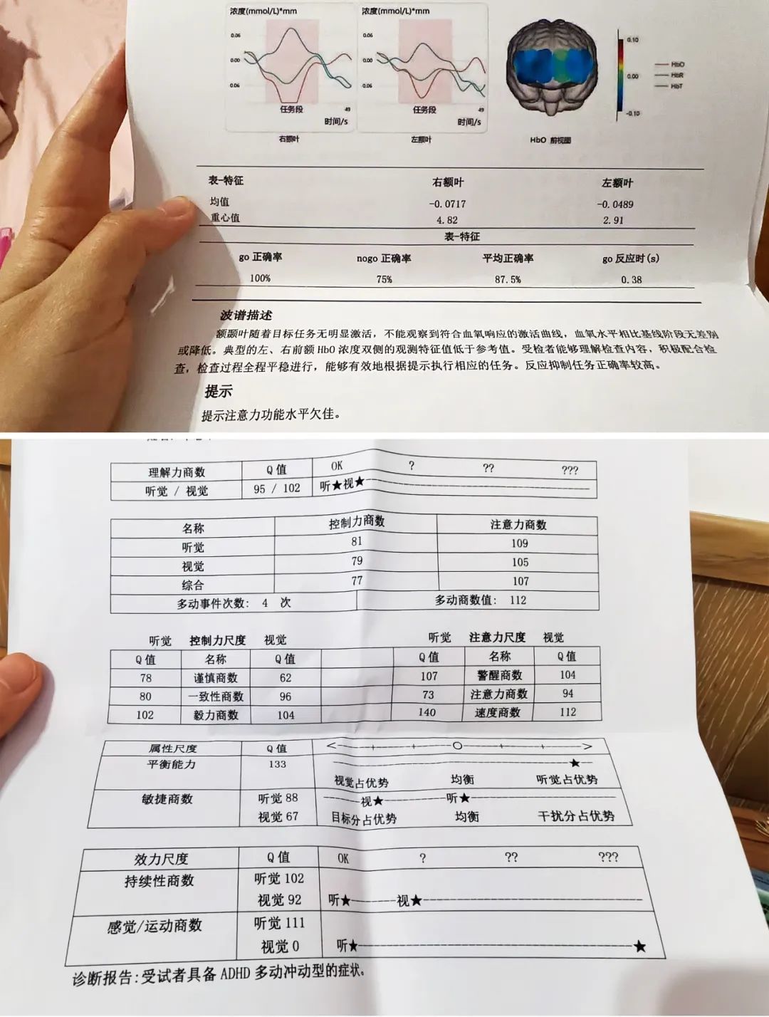上图：2024年12月，复旦大学附属儿科医院学习与阅读障碍门诊出具的患儿近红外脑功能检查报告。图/受访者提供