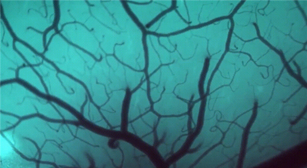 1.5秒植入！马斯克脑机接口公司技术新突破 超万人等待上脑