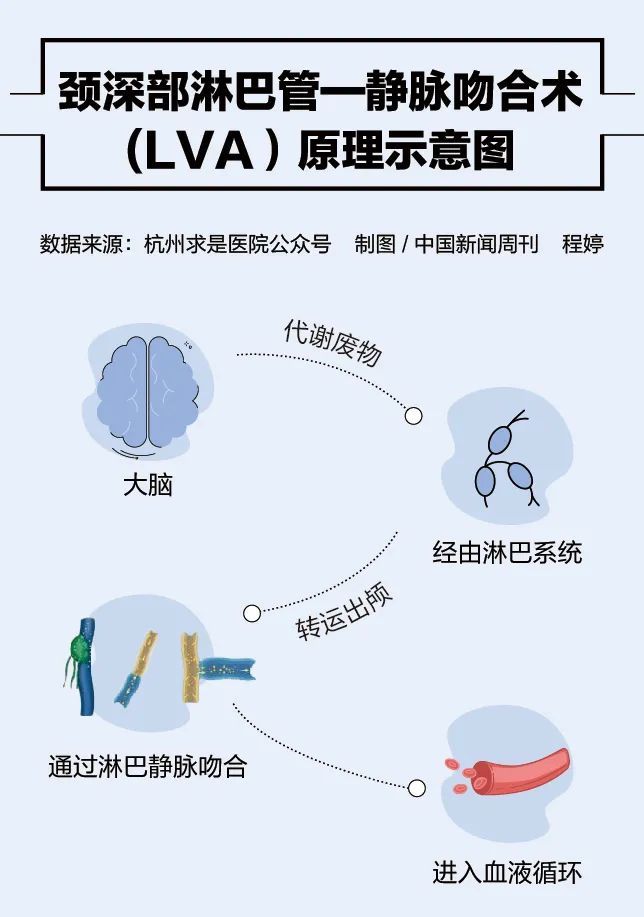 手术治疗老年痴呆靠谱吗?最高收费达21万,国家卫健委叫停