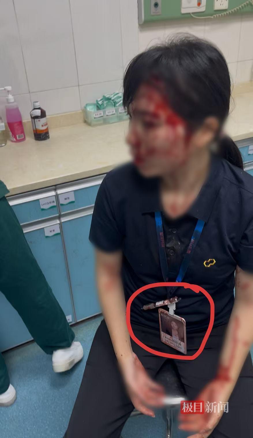 陈女士头部被砸伤(受访者供图)