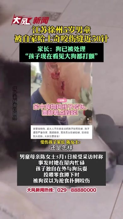 江苏徐州5岁男童被自家哈士奇咬伤缝近50针 家长：狗已被处理“孩子现在看见大狗都打颤”