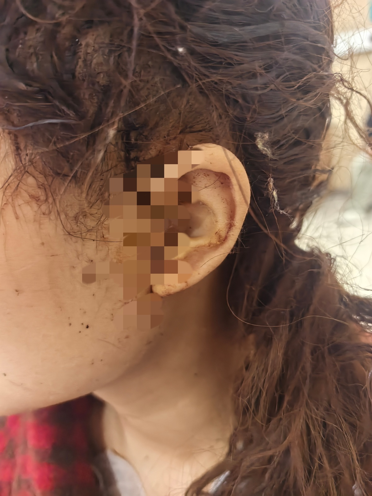 16岁女孩称被闺蜜刺成重伤，事发后对方自杀身亡，当事人回应